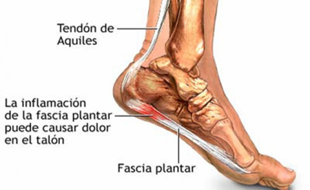 Los mejores ejercicios para recuperarse de la Fascitis Plantar